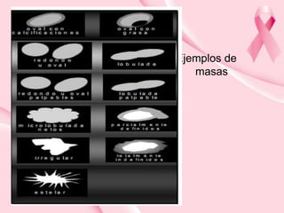 Ejemplos de
masas

 
