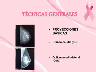 TÉCNICAS GENERALES
• PROYECCIONES
BÁSICAS
-

Cráneo-caudal (CC)

-

Oblicua-medio-lateral
(OML)

 