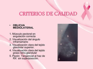CRITERIOS DE CALIDAD
• OBLICUA
MEDIOLATERAL
1. Músculo pectoral en
angulación correcta
2. Visualización del ángulo
inframamario
3. Visualización clara del tejido
glandular superior.
4. Visualización clara del tejido
graso retro-glandular
5. Pezón Tangencial al haz de
RX sin superposición.

 