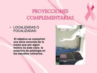 PROYECCIONES
COMPLEMENTARIAS
• LOCALIZADAS O
FOCALIZADAS:
El objetivo es comprimir
una zona concreta de la
mama que por algún
motivo no este clara la
ausencia de patología en
los estudios rutinarios.

 