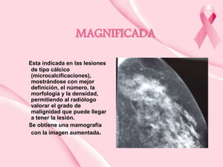 MAGNIFICADA
Esta indicada en las lesiones
de tipo cálcico
(microcalcificaciones),
mostrándose con mejor
definición, el número, la
morfología y la densidad,
permitiendo al radiólogo
valorar el grado de
malignidad que puede llegar
a tener la lesión.
Se obtiene una mamografía
con la imagen aumentada.

 