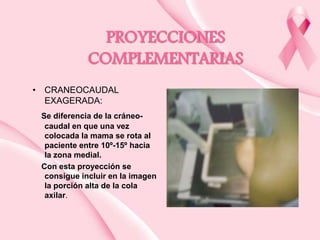 PROYECCIONES
COMPLEMENTARIAS
• CRANEOCAUDAL
EXAGERADA:
Se diferencia de la cráneocaudal en que una vez
colocada la mama se rota al
paciente entre 10º-15º hacia
la zona medial.
Con esta proyección se
consigue incluir en la imagen
la porción alta de la cola
axilar.

 
