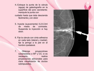 4.-Coloque la punta de la cánula
(aguja) de galactografía en la
superficie del poro secretante;
manipule la punta con
cuidado hasta que ésta descienda
fácilmente y sin dolor
5. Inyecte (suavemente) 0,2-0,3ml
de
medio
de
contraste.
Suspenda la inyección si hay
dolor.
6. Fije la cánula con cinta adhesiva
en cada lado (lateral y medial);
fije la jeringa a la piel en el
hombro ipsilateral.
7.

Obtenga
proyecciónes
subareolares a 90º y CC; si es
necesario,
realice
proyecciones adicionales para
clara visualización de ductos
sobrepuestos.

 