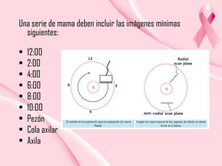 Una serie de mama deben incluir las imágenes mínimas
siguientes:
•
•
•
•
•
•
•
•
•

12:00
2:00
4:00
6:00
8:00
10:00
Pezón
Cola axilar
Axila

 