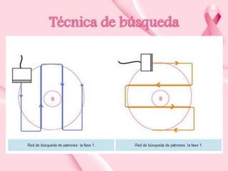 Técnica de búsqueda

 
