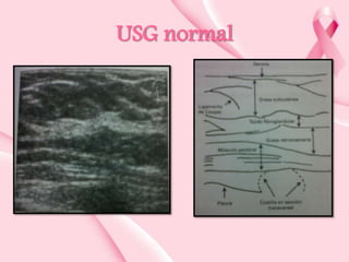 USG normal

 