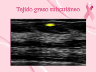 Tejido graso subcutáneo

 