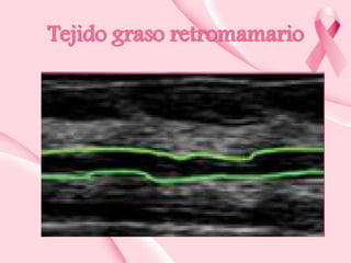 Tejido graso retromamario

 