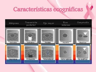 Características ecográficas

 
