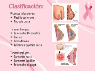 Clasificación:
Procesos inflamatorios:
• Mastitis bacteriana
• Necrosis grasa
Tumores benignos:
• Enfermedad fibroquistica
• Quistes
• Fibroadenoma
• Adenoma o papiloma ductal
Tumores malignos:
• Carcinoma ductal
• Carcinoma lobulillar
• Enfermedad de paget

 