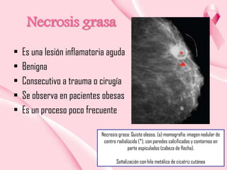 Necrosis grasa
•
•
•
•
•

Es una lesión inflamatoria aguda
Benigna
Consecutivo a trauma o cirugía
Se observa en pacientes obesas
Es un proceso poco frecuente
Necrosis grasa: Quiste oleoso. (a) mamografía: imagen nodular de
centro radiolúcido (*), con paredes calcificadas y contornos en
parte espiculados (cabeza de flecha).
Señalización con hilo metálico de cicatriz cutánea

 