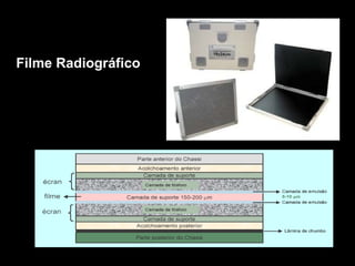 Filme Radiográfico 