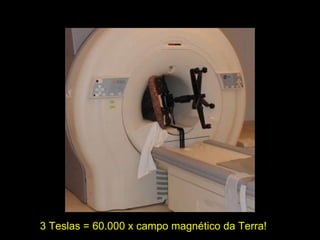 3 Teslas = 60.000 x campo magnético da Terra! 