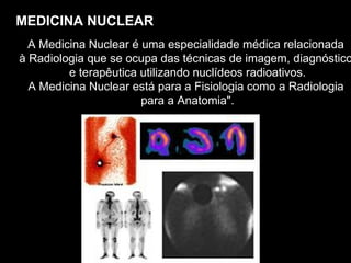 MEDICINA NUCLEAR A Medicina Nuclear é uma especialidade médica relacionada  à Radiologia que se ocupa das técnicas de imagem, diagnóstico  e terapêutica utilizando nuclídeos radioativos. A Medicina Nuclear está para a Fisiologia como a Radiologia  para a Anatomia". 