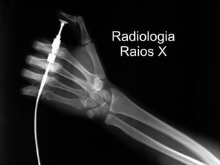 Radiologia    Raios X 