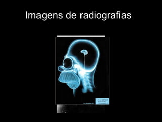 Imagens de radiografias  