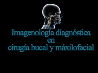 Imagenología diagnóstica en cirugía bucal y máxilofacial
 