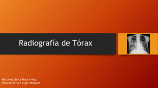 Radiografía de Tórax
Martínez de la Rosa Irving
Ricardo Arturo Lugo Vázquez
 