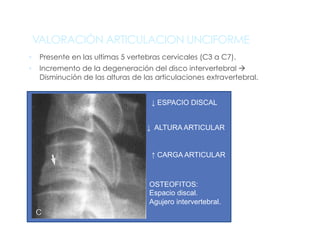 VALORACIÓN ARTICULACION UNCIFORME
§  Presente en las ultimas 5 vertebras cervicales (C3 a C7).
§  Incremento de la degeneración del disco intervertebral à
Disminución de las alturas de las articulaciones extravertebral.
↓ ESPACIO DISCAL
↓ ALTURA ARTICULAR
↑ CARGA ARTICULAR
OSTEOFITOS:
Espacio discal.
Agujero intervertebral.
 