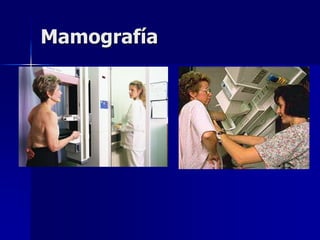 Mamografía
 