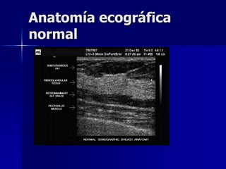 Anatomía ecográfica
normal
 