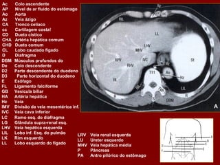 Ac    Colo ascendente
AP    Nível de ar fluido do estômago
Ao    Aorta
Az    Veia ázigo
CA    Tronco celíaco
cc    Cartilagem costa!
CD    Dueto cístico
CHA   Artéria hepática comum
CHD   Dueto comum
CL    Lobo caudado fígado
D     Diafragma
DBM   Músculos profundos do
De    Colo descendente
D2    Parte descendente do duodeno
D3     Parte horizontal do duodeno
E     Esôfago
FL    Ligamento falciforme
GB    Vesícula biliar
HA    Artéria hepática
Hz    Veia
IMV   Divisão da veia mesentérica inf.                                A
IVC   Veia cava inferior
LC    Ramo esq. do diafragma
LG    Glândula supra-renal esq.
LHV   Veia hepática esquerda
LIL   Lobo inf. Esq. do pulmão       LRV Veia renal esquerda
LK    Rim esquerdo                   LU  Ureter esquerdo
LL    Lobo esquerdo do fígado        MHV Veia hepática média
                                     P   Pâncreas
                                     PA  Antro pilórico do estômago
 