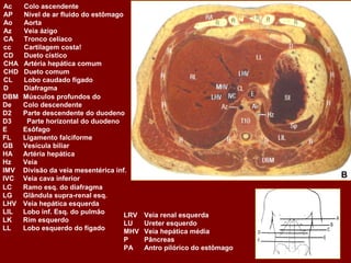 Ac    Colo ascendente
AP    Nível de ar fluido do estômago
Ao    Aorta
Az    Veia ázigo
CA    Tronco celíaco
cc    Cartilagem costa!
CD    Dueto cístico
CHA   Artéria hepática comum
CHD   Dueto comum
CL    Lobo caudado fígado
D     Diafragma
DBM   Músculos profundos do
De    Colo descendente
D2    Parte descendente do duodeno
D3     Parte horizontal do duodeno
E     Esôfago
FL    Ligamento falciforme
GB    Vesícula biliar
HA    Artéria hepática
Hz    Veia
IMV   Divisão da veia mesentérica inf.
IVC   Veia cava inferior                                              B
LC    Ramo esq. do diafragma
LG    Glândula supra-renal esq.
LHV   Veia hepática esquerda
LIL   Lobo inf. Esq. do pulmão       LRV Veia renal esquerda
LK    Rim esquerdo                   LU  Ureter esquerdo
LL    Lobo esquerdo do fígado        MHV Veia hepática média
                                     P   Pâncreas
                                     PA  Antro pilórico do estômago
 