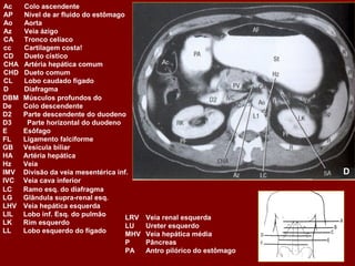 Ac    Colo ascendente
AP    Nível de ar fluido do estômago
Ao    Aorta
Az    Veia ázigo
CA    Tronco celíaco
cc    Cartilagem costa!
CD    Dueto cístico
CHA   Artéria hepática comum
CHD   Dueto comum
CL    Lobo caudado fígado
D     Diafragma
DBM   Músculos profundos do
De    Colo descendente
D2    Parte descendente do duodeno
D3     Parte horizontal do duodeno
E     Esôfago
FL    Ligamento falciforme
GB    Vesícula biliar
HA    Artéria hepática
Hz    Veia
IMV   Divisão da veia mesentérica inf.                                D
IVC   Veia cava inferior
LC    Ramo esq. do diafragma
LG    Glândula supra-renal esq.
LHV   Veia hepática esquerda
LIL   Lobo inf. Esq. do pulmão       LRV Veia renal esquerda
LK    Rim esquerdo                   LU  Ureter esquerdo
LL    Lobo esquerdo do fígado        MHV Veia hepática média
                                     P   Pâncreas
                                     PA  Antro pilórico do estômago
 