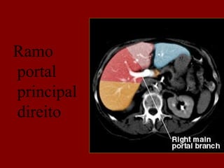 Ramo
portal
principal
direito
 