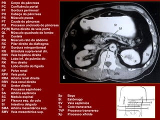 PB    Corpo do pâncreas
PC    Confluência portal
PF    Gordura perirrenal
PH    Cabeça do pâncreas
PS    Músculo psoas
PT    Cauda do pâncreas
PU    Processo uncinado do pâncreas
PV(R) Ramo direito da veia porta
QL    Músculo quadrado do lombo
R     Costela
RA    Músculo reto do abdome
RC    Pilar direito do diafragma
RF    Gordura retroperitoneal
RG Glândula supra-renal dir.
RHV Veia hepática direita
RIL Lobo inf. do pulmão dir.
RK    Rim direito
RL    Lobo direito do fígado
RP    Pelve renal
RPV Veia porta
RRA Artéria renal direita             E
RRV Veia renal direita
RU    Ureter direito
S     Processo espinhoso
SA    Artéria esplênica
SC    Medula espinal               Sp     Baço
SF    Flexura esq. do colo         St     Estômago
SI    Intestino delgado            SV     Veia esplênica
SMA Artéria mesentérica sup.       Tc     Coto transverso
SMV Veia mesentérica sup.          TVP    Processo transverso
                                   Xp     Processo xifóide
 