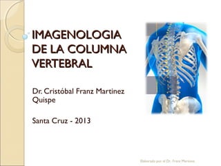 IMAGENOLOGIAIMAGENOLOGIA
DE LA COLUMNADE LA COLUMNA
VERTEBRALVERTEBRAL
Dr. Cristóbal Franz Martinez
Quispe
Santa Cruz - 2013
Elaborado por el Dr. Franz Martinez
 