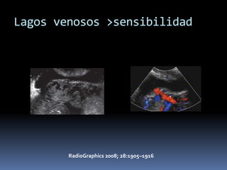 Lagos venosos >sensibilidad




        RadioGraphics 2008; 28:1905–1916
 