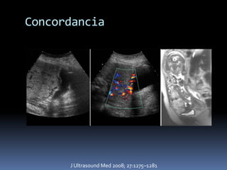 Concordancia




      J Ultrasound Med 2008; 27:1275–1281
 