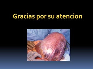 Imagenologia de la placenta acreta.