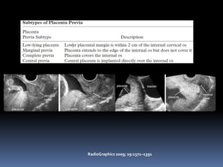 RadioGraphics 2009; 29:1371–1391
 