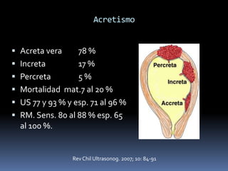 Acretismo


 Acreta vera       78 %
   Increta         17 %
   Percreta        5%
   Mortalidad mat.7 al 20 %
   US 77 y 93 % y esp. 71 al 96 %
   RM. Sens. 80 al 88 % esp. 65
    al 100 %.


                  Rev Chil Ultrasonog. 2007; 10: 84-91
 