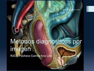 Metodos diagnosticos por
imagen
R2CG Pacheco Carrillo Ana Lilia
Radiología. 2010;52(1):18-29
 