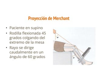 Imagenologia de rodilla_.pptx