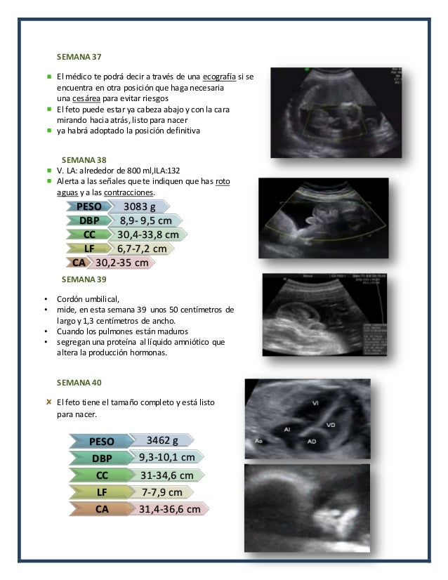 Embarazo Por Semanas Imagenologia Embarazo Por Semanas Imagenologia