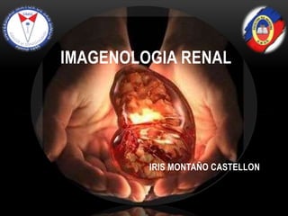 IRIS MONTAÑO CASTELLON
IMAGENOLOGIA RENAL
 