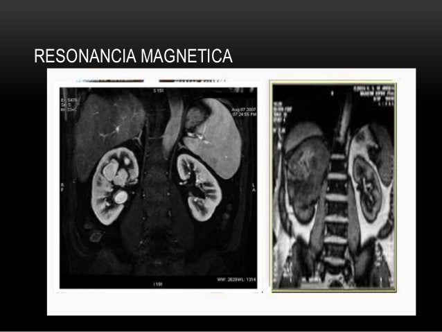 Imagenologia renal