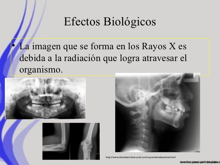 Rayos X antecedentes y generalidades