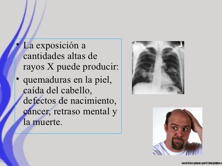 Rayos X antecedentes y generalidades