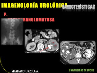 P.  XANTOGRANULOMATOSA IMAGENOLOGÍA UROLÓGICA 