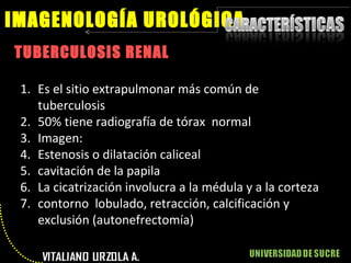 TUBERCULOSIS RENAL IMAGENOLOGÍA UROLÓGICA Es el sitio extrapulmonar más común de tuberculosis 50% tiene radiografía de tórax  normal Imagen:  Estenosis o dilatación caliceal cavitación de la papila La cicatrización involucra a la médula y a la corteza contorno  lobulado, retracción, calcificación y exclusión (autonefrectomía) 