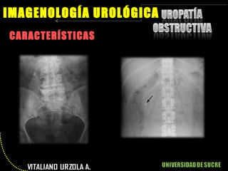 CARACTERÍSTICAS IMAGENOLOGÍA UROLÓGICA 