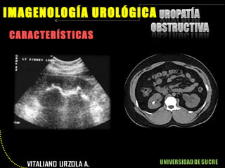 CARACTERÍSTICAS IMAGENOLOGÍA UROLÓGICA 