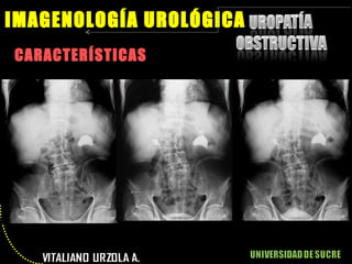 CARACTERÍSTICAS IMAGENOLOGÍA UROLÓGICA 