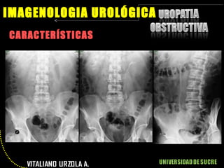 CARACTERÍSTICAS IMAGENOLOGIA UROLÓGICA 