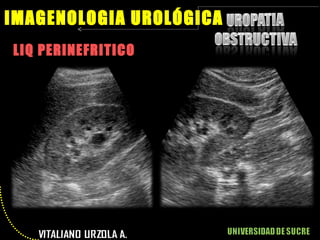 LIQ PERINEFRITICO IMAGENOLOGIA UROLÓGICA 